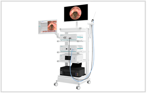 耳鼻喉科全高清内窥镜摄像系统